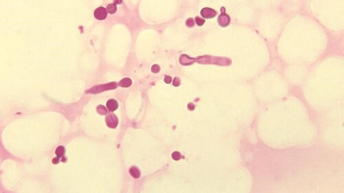 Seminarium naukowe mgr Sandry Chmielewskiej